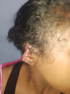 Detenido hombre por golpear y arrancarle un pedazo de oreja a su concubina en Maracaibo