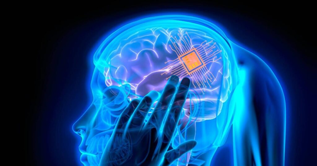 ¿Ha sido Elon Musk el primero en implantar un chip en un cerebro humano?