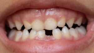 El primer fármaco del mundo para hacer crecer los dientes empezará a ensayarse en humanos este año - AlbertoNews