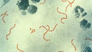 Japón registra cifras récords de infección por un estreptococo 'carnívoro' letal - AlbertoNews