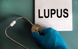 "Los fármacos actuales contra el lupus son realmente prometedores"