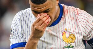 Kylian Mbappé sufre una fractura nasal y será operado