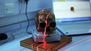 Un cráneo revela que los egipcios intentaron operar un tumor hace más de 4000 años