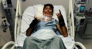médico que lo salvó tras accidente dijo que pudo quedar parapléjico