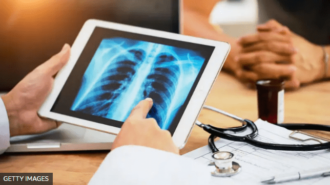 4 novedades alentadoras sobre los tratamientos contra el cáncer que extienden la vida de los pacientes