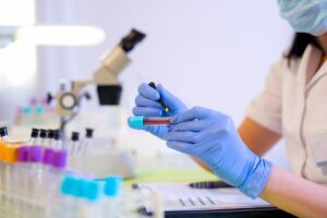Desarrollan un método de análisis de sangre que ayuda a mejorar los tratamientos contra el cáncer