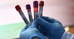 El análisis de sangre para detectar cáncer de colon que está en pruebas en EEUU: “Podría detectar el cáncer de colon antes de que se propague”