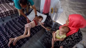 Gaza enfrenta serios problemas de desnutrición en la población