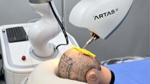 así es ARTAS iX, el robot que te devuelve el pelo