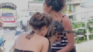 la impresionante herida con machete en la cabeza a joven de 14 años de edad y el milagro de seguir con vida