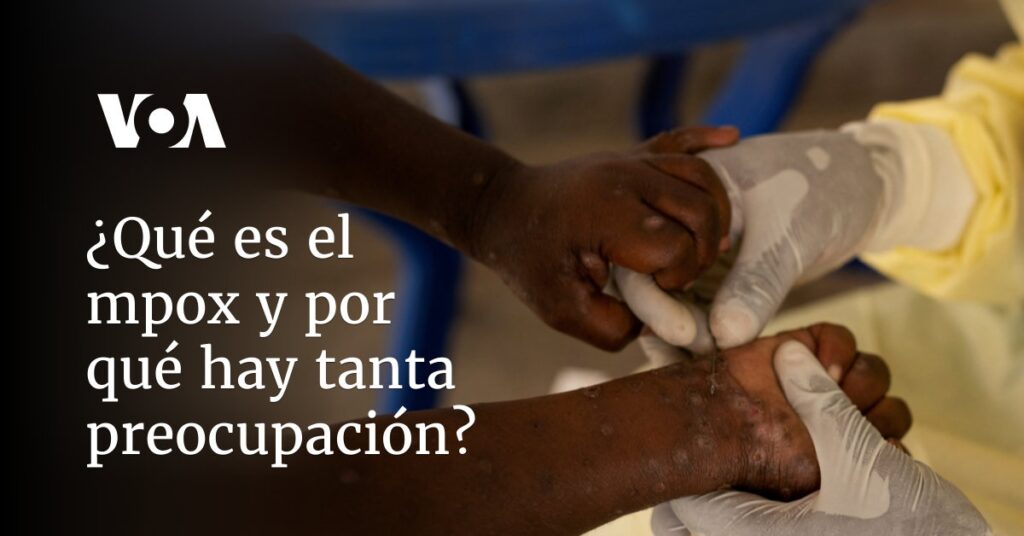 ¿Qué es el mpox y por qué hay tanta preocupación?