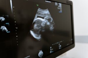 Brasil registra un caso de anomalía congénita de un bebe asociado al virus oropouche - AlbertoNews