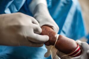 China aprueba la comercialización de su primer test para detectar el virus mpox - AlbertoNews