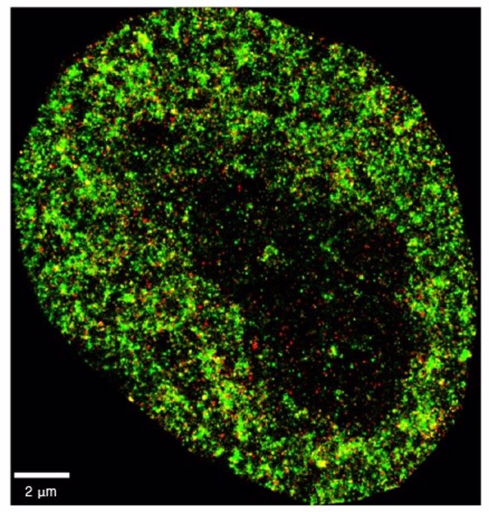 Desarrollan una IA que detecta el cáncer e infecciones virales con "precisión nanométrica"
