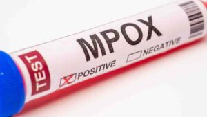 Establecerán cercos epidemiológicos en Mérida para prevenir contagios de mpox