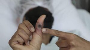 Filipinas dice que caso de mpox no es de la variante mortal: “Es la variante antigua” - AlbertoNews