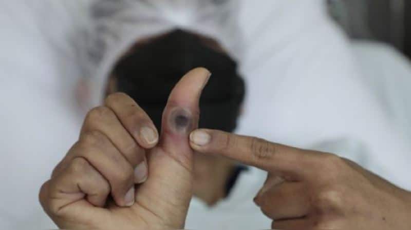 Filipinas dice que caso de mpox no es de la variante mortal: “Es la variante antigua” - AlbertoNews