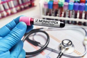 Sanidad registra 7 casos de mpox desde el 8 de agosto, todos de la antigua variante y el 98% en hombres