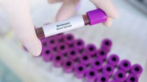 Tailandia confirma el primer caso en Asia de la nueva variante de mpox - AlbertoNews