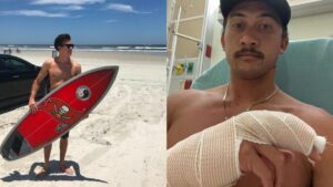 Video: hombre sobrevivió a feroz ataque de un tiburón: 'Sentí dientes afilados'