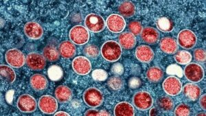 descartan que uno de los tripulantes de buque en el río Paraná tenga mpox