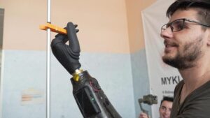 Desarrollan la primera prótesis controlada a través de imanes | Diario El Luchador