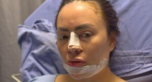 'Epa Colombia' mostró su estado de salud, luego de someterse a varias operaciones