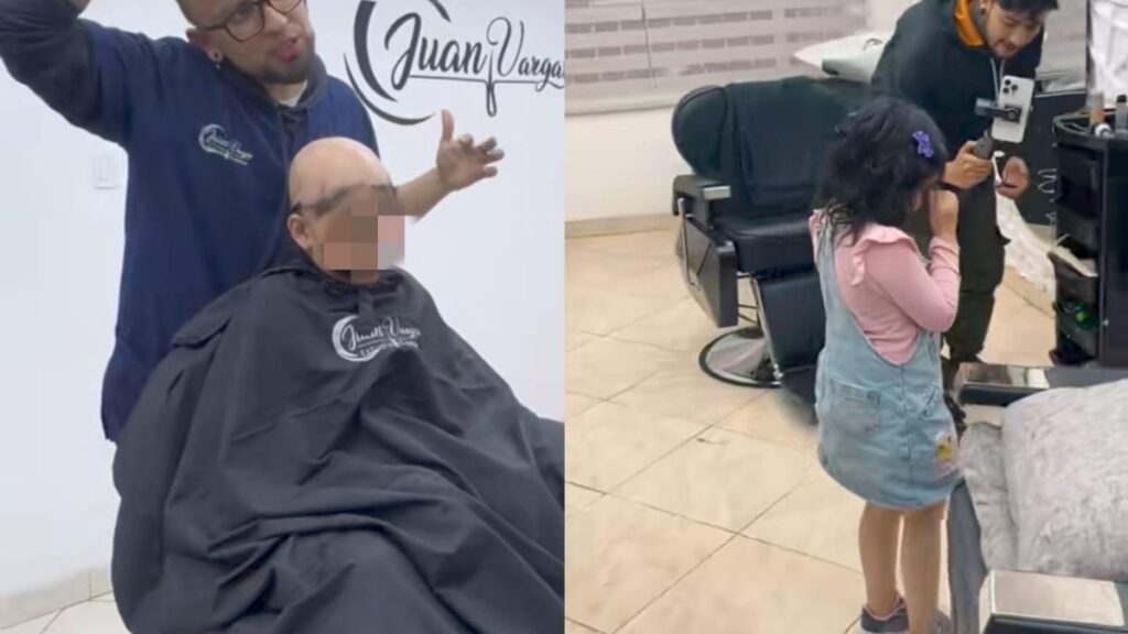 Esta fue la reacción de una niña con alopecia que recibió un implante capilar, se pudo peinar por primera vez: conmovió las redes sociales
