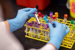 Identifican en sangre nuevos cambios tempranos en el cerebro de personas en riesgo de Alzheimer