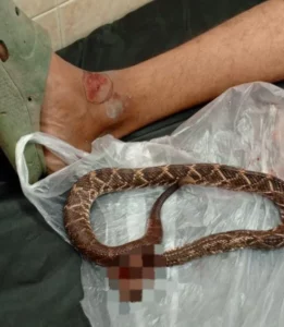 Joven fue mordido por una cascabel en San Joaquin