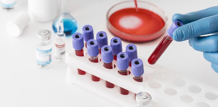 Laboratorio completamente automatizado reduce errores