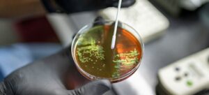 Pactan acuerdo en la ONU sobre resistencia a los antimicrobianos