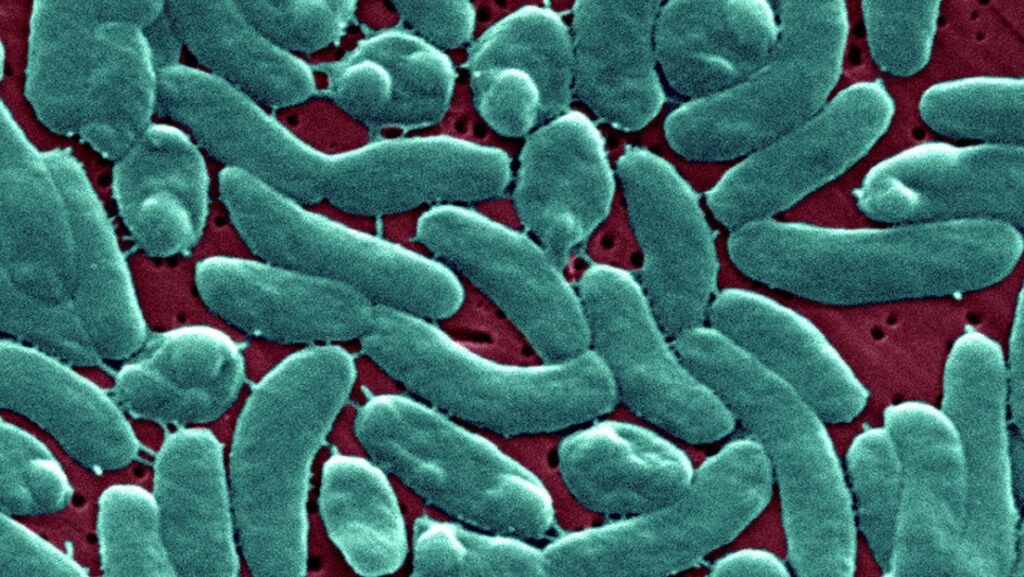 Alerta en Florida por el aumento de infecciones de bacteria 'carnívora' - AlbertoNews