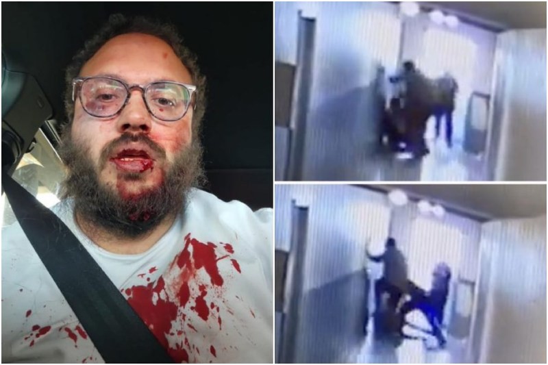 golpearon a trabajador porque se negó a que ocuparan un apartamento vacío (+Video)
