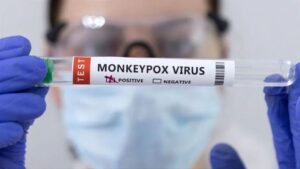 la OMS aprobó un test PCR para detectar la enfermedad