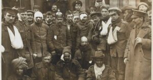 ¿Qué tienen en común la Primera Guerra Mundial y la cirugía plástica?