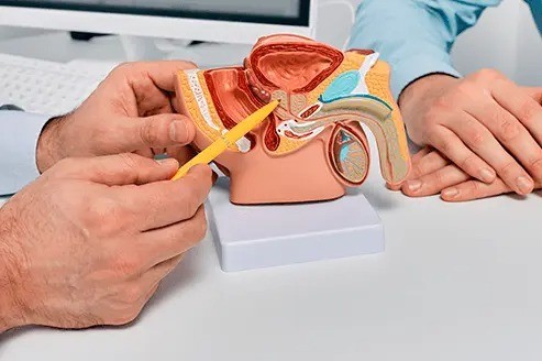 Aumentan casos de cáncer de próstata y hay que cuidarse