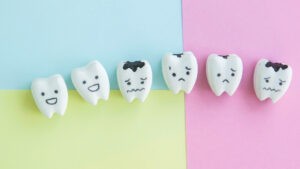Dentistas estadounidenses extraen dientes sanos para beneficiarse de los implantes - AlbertoNews