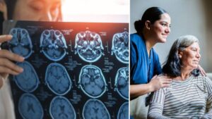 El método japonés de tres preguntas que puede ayudar a diagnosticar el Alzheimer en etapas tempranas