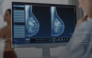 Llegó el más avanzado software de detección temprana de cáncer