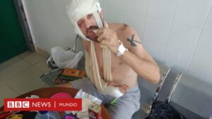 Morgan Segui: "Un rebaño de cabras me salvó la vida tras pasar 3 días malherido y solo en la jungla"