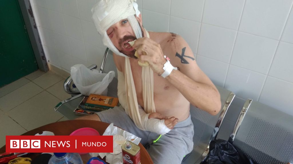 Morgan Segui: "Un rebaño de cabras me salvó la vida tras pasar 3 días malherido y solo en la jungla"