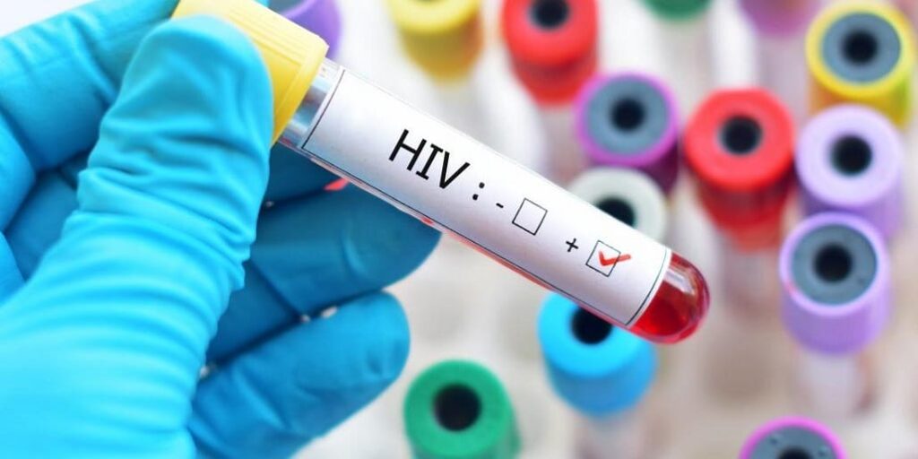 Perú permitirá a extranjeros con tuberculosis y VIH afiliarse al seguro de salud estatal - AlbertoNews