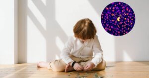 Científicos españoles desentrañan un misterio clave que podría explicar el 80% de los casos de autismo
