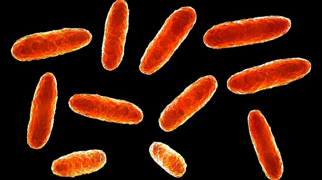 Klebsiella oxytoca