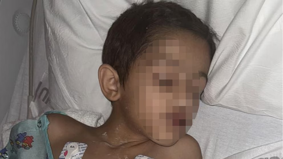 Niño herido por dron durante espectáculo en Florida se recupera y recibe regalos de un sheriff - AlbertoNews