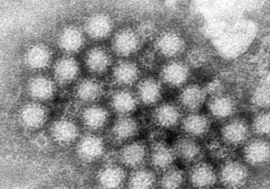 Qué es el norovirus, la infección que enciende las alarmas en Estados Unidos - AlbertoNews