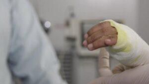 fortalecen capacidades por incremento en el número de quemados con pólvora