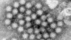 ¿Qué es el norovirus y por qué preocupa en esta temporada en EEUU?