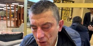 Agreden brutalmente al ex primer ministro de Georgia en un hotel
